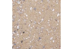 Dihl 20KG Aviary Bird Cage Sand with Oystershell, Calcium & Minerals Aids Digestive Health and General Well Being. Premium Quality for all Birds, 20 KG