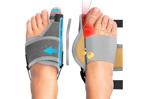 Vicloon Hallux Valgus-concealer, 2 st ortopedisk lökskena, hallux Valgus icke-kirurgisk korrigering för dag/nattstöd, stort tåstöd med 4 aluminiumstänger