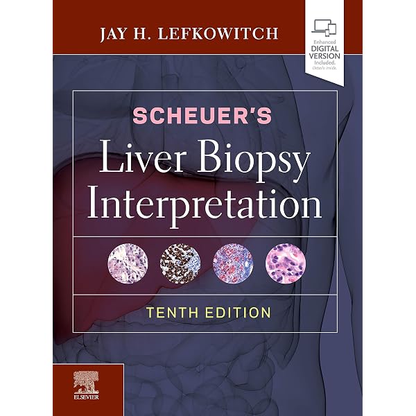 Buy MacSween's Pathology of the Liver Book Online at Low Prices in