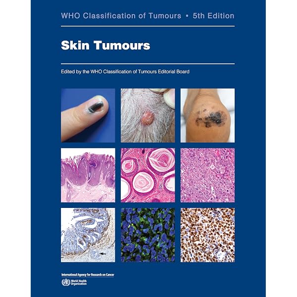 Lever's Dermatopathology: Histopathology of the Skin