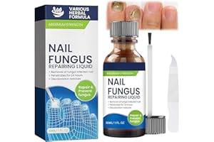 FRESFRESI Nail Repairing Liquid, Speedy and Effective Approach to Toenail Issues - Combating Thick, Discolored Nails - Powerful Solution for Addressing Yellow and Brown Nails
