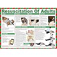 Safety First Aid Group Resuscitation of Adults Poster Laminated, A2