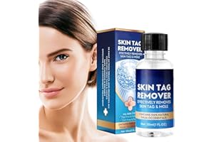 NAIYAN 30ml Azote Liquide Anti Verrues | Acrochordons Traitement Efficace | Liquide D'élimination Indolore Des Verrues | Solution De Traitement Verrues Plantaire | Génitales, Élimination Des Verrues