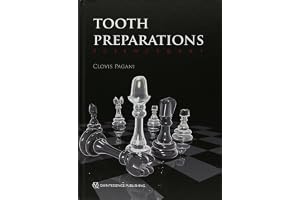 Tooth Preparations: Science & Art