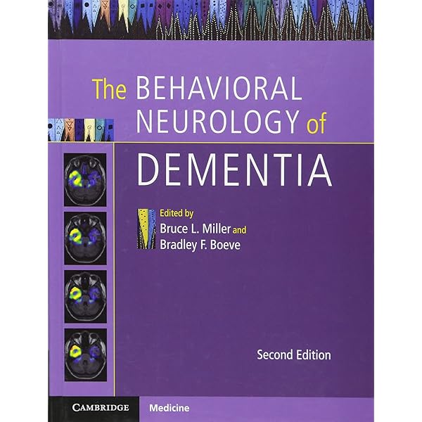 Buy Memory Loss Alzheimers Disease And Dementia A Practical Guide
