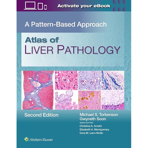Buy MacSween's Pathology of the Liver Book Online at Low Prices in