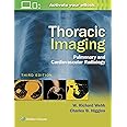 Thoracic Imaging: Pulmonary and Cardiovascular Radiology