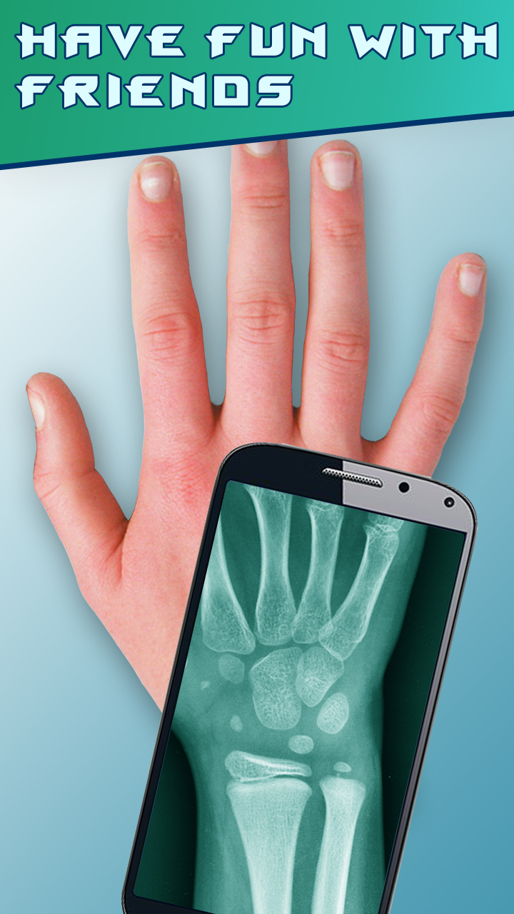 Amazing XRay Amazon.co.uk Apps & Games