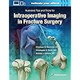 ILLUSTRATED TIPS AND TRICKS FOR INTRAOPERATIVE IMAGING IN FRACTURE SURGERY (HB 2018)