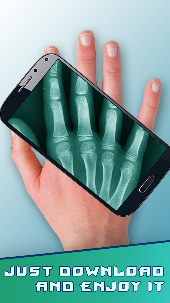 Amazing XRay Amazon.co.uk Apps & Games