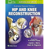 Buy Harborview Illustrated Tips And Tricks In Fracture