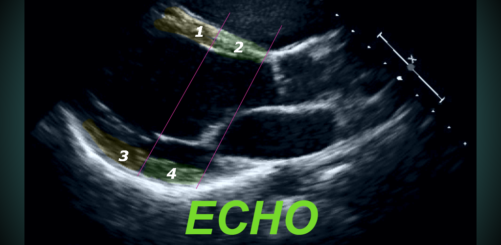 LEARN THE FULL TTE ECHO ULTRASOUND PROTOCOL DEMO Amazon.co.uk