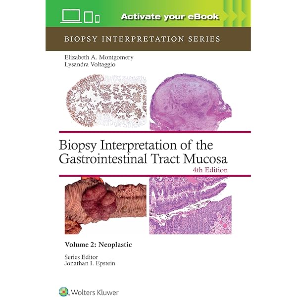 Buy MacSween's Pathology of the Liver Book Online at Low Prices in