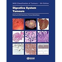 語学+参考書 WHO Classification of Tumours of Haematopoietic and Lymphoid Tissues (World Health Organization Classification of Tumours) WHO Classification of Tumours of Haematopoietic and Lymphoid
