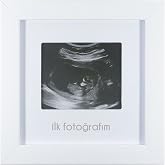 FUFİZU İlk Fotoğrafım Bebek Ultrason &Ccedil;er&ccedil;evesi - Bebek Odası Resim Anı &Ccedil;er&ccedil;evesi