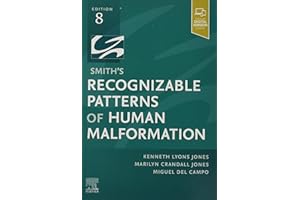 Smith's Recognizable Patterns of Human Malformation: Expert Consult - Online and Print