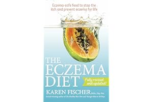 The Eczema Diet: Eczema-safe Food to Stop the Itch and Prevent Eczema for Life