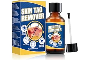 Bellifluous Warzenentferner, Hühneraugen Entferner mit Hühneraugenpflaster, 20ml Flüssig Dornwarzen Entfernen Fuß, Schnell Wirkend Warzen Entfernen für Plantarwarze, Gewöhnliche Und Flache Warzen