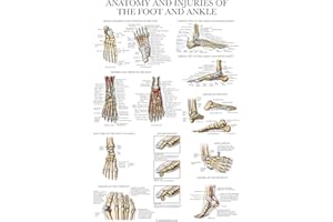 Palace Learning Laminated Anatomy and Injuries of the Foot and Ankle Poster - Anatomical Chart of Foot and Ankle Joint - 18" x 24"