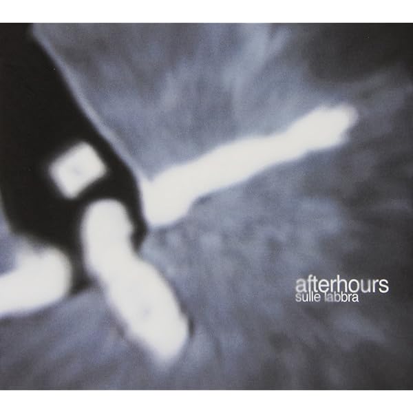 【中古】 Siam Tre Piccoli Porcellini－Live Afterhours Siam Tre Piccoli Porcellini - Live: Afterhours: Amazon.it
