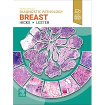 Buy Rosen's Diagnosis of Breast Pathology by Needle Core Biopsy