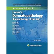 Lever's Dermatopathology: Histopathology of the Skin