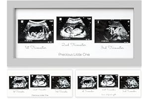 KEABABIES Trio Baby Bilderrahmen für Ultraschallbilder - Bilderrahmen Ultraschallbild Baby, Ultraschall Bilderrahmen Schwangerschaft, Ultraschallbilder Rahmen, Geschenke für Werdende Mamas (Cloud Gray)
