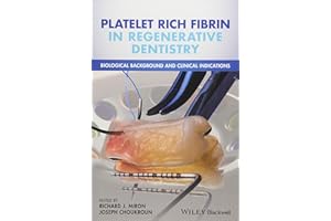 Platelet Rich Fibrin in Regenerative Dentistry: Biological Background and Clinical Indications
