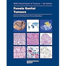 Breast Tumours (World Health Organization Classification of Tumours， 2) WHO Classification of Tumours, 5th ed., Vol.2 Breast Tumours