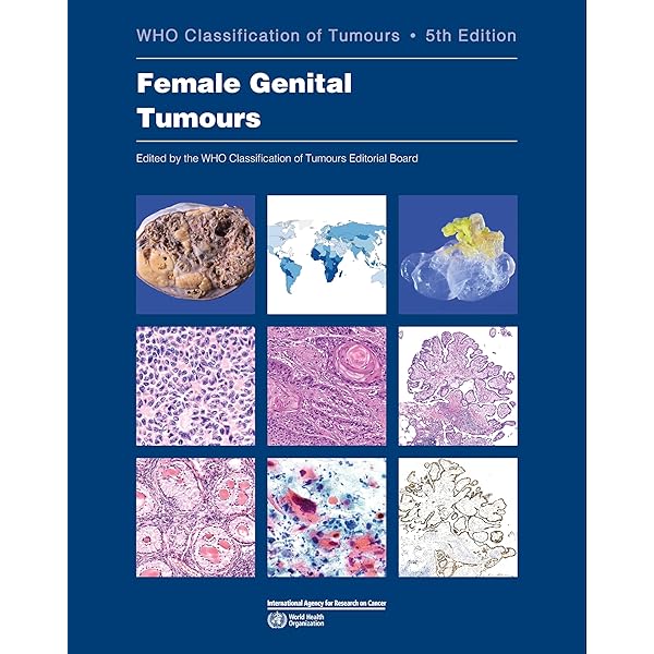 Buy WHO Classification of Breast Tumours: WHO Classification