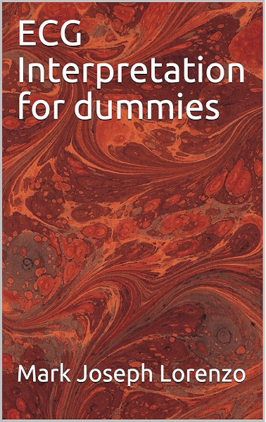 Ecg for dummies book