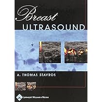 Buy Breast Ultrasound Book Online at Low Prices in India
