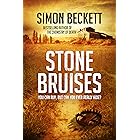 Stone Bruises