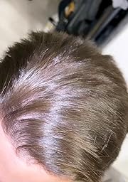 lissage bresilien rate