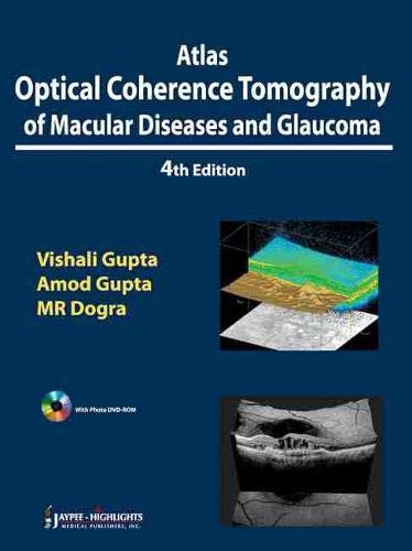 Atlas Optical Coherence Tomography of Macular Diseases and Glaucoma Gupta, Vishali Gupta, Amod and Dogra, Mangat Ram