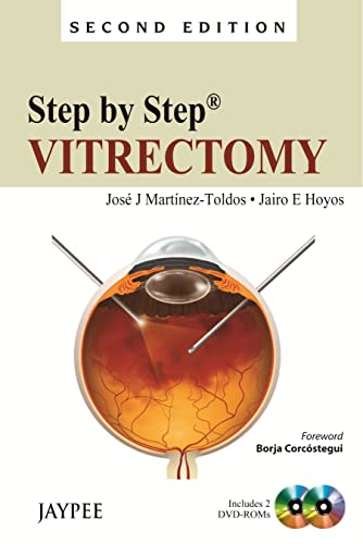 Step by Step: Vitrectomy Martinez-Toldos, Jose J. and Hoyos, Jairo E.