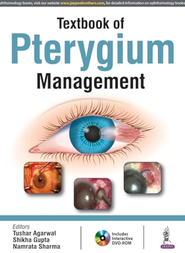 Textbook of Pterygium Management Agarwal, Tushar Gupta, Shikha and Sharma, Namrata